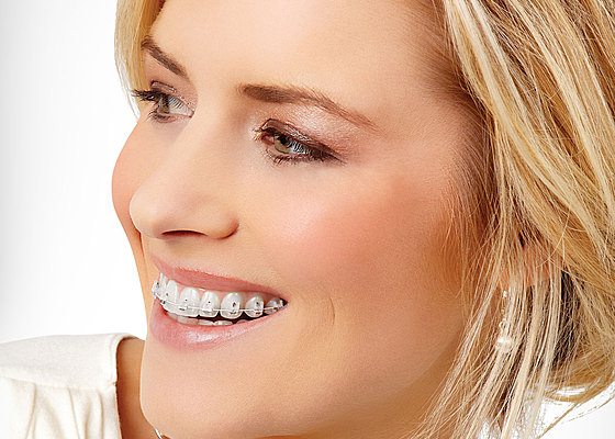 aparat ortodontyczny