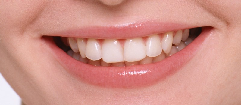 wkład koronowo-korzeniowy