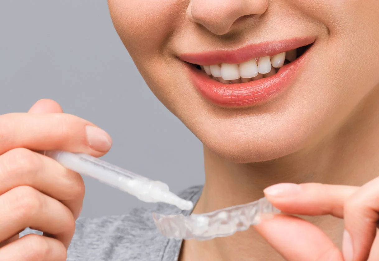 wybielanie zębów nakładkami